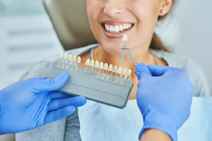 Dental professional comparing a shade tab to a patient smile with a full shade guide during color matching at MAP Dental Center Houston on Greenhouse Rd.