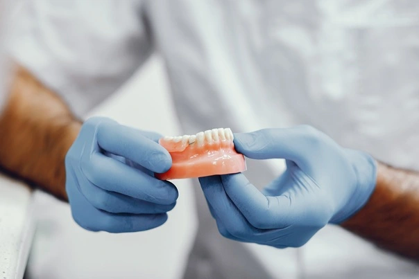 MAP Dental partial denture craftsmanship West Houston — MAP Dental Center Houston.