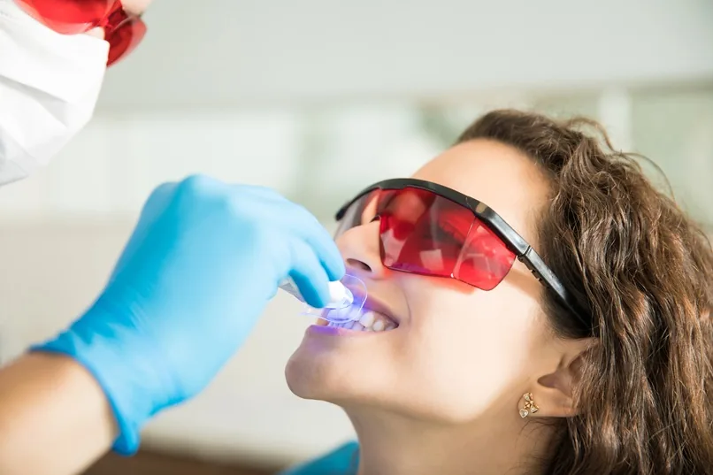 MAP Dental professional whitening West Houston — MAP Dental Center Houston Greenhouse Rd.