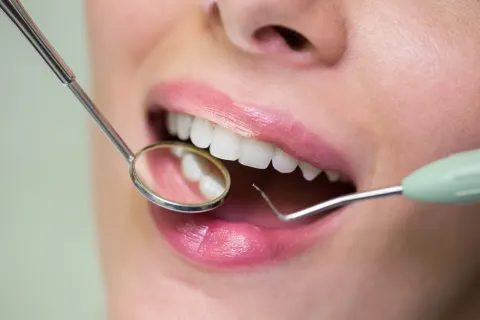 General Dentistry service photography — MAP Dental Center Houston, TX